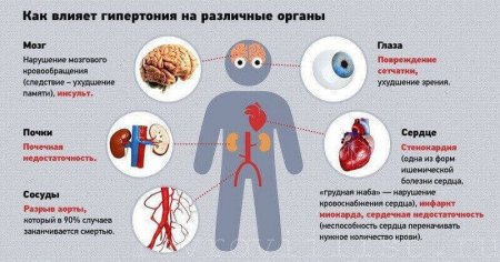 Схема влияния гипертонии на органы человека